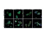 Hypoxic Signaling: Recombinant Rabbit Monoclonal Antibodies for HIF1-alpha and HIF2-alpha
