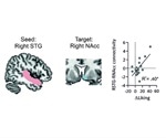 Communication between the brain’s auditory and reward circuits underpins music-induced pleasure