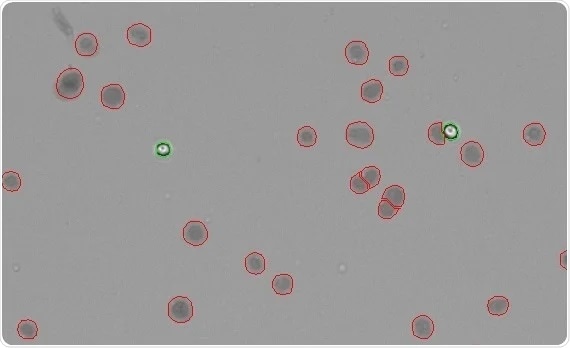 Isolated nuclei counted with trypan blue on the CellDrop. The CellDrop does an excellent job of recognizing isolated nuclei in a carefully purified isolation of HEK293T cells. The nuclei are stained dark, indicating uptake of the trypan blue dye (circled red), while intact cells exclude the dye and remain bright (circled green).