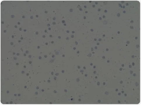 Automated image analysis of trypan blue stained cells.