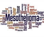 Mesothelioma Symptoms