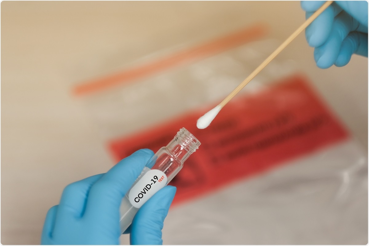 Study: Dry Swab Method of sample collection for SARS-CoV2 testing can be used for culturing virus. Horth Rasur / Shutterstock