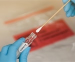 Could dry swabs provide cheaper, safer and faster material for SARS-CoV-2 testing?