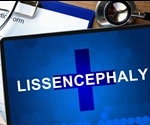 Lissencephaly Symptoms