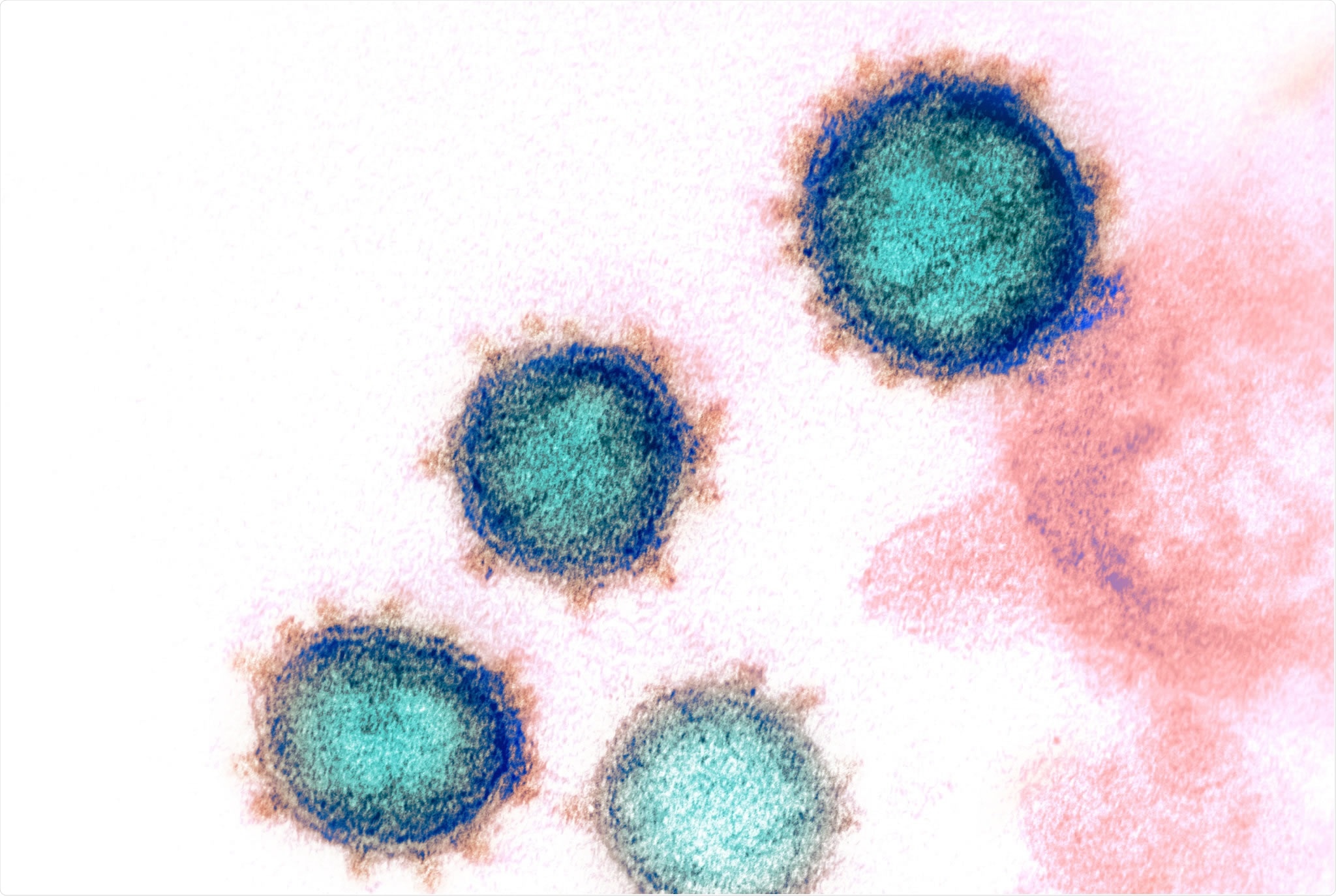 A pair of non-competing neutralizing human monoclonal antibodies protecting from disease in a SARS-CoV-2 infection model. Image Credit: NIAID