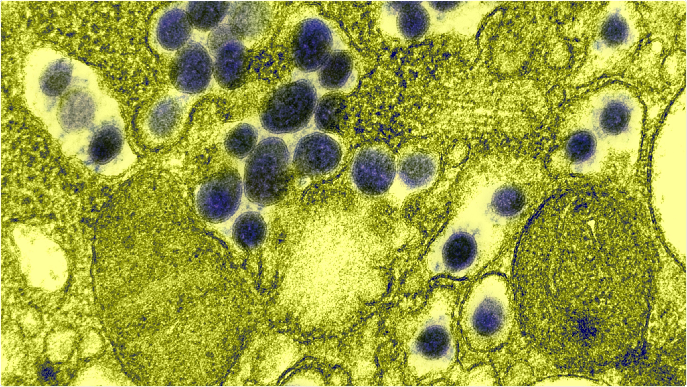 Study: Identification of natural SARS-CoV-2 infection in seroprevalence studies among vaccinated populations. Image Credit: NIAID