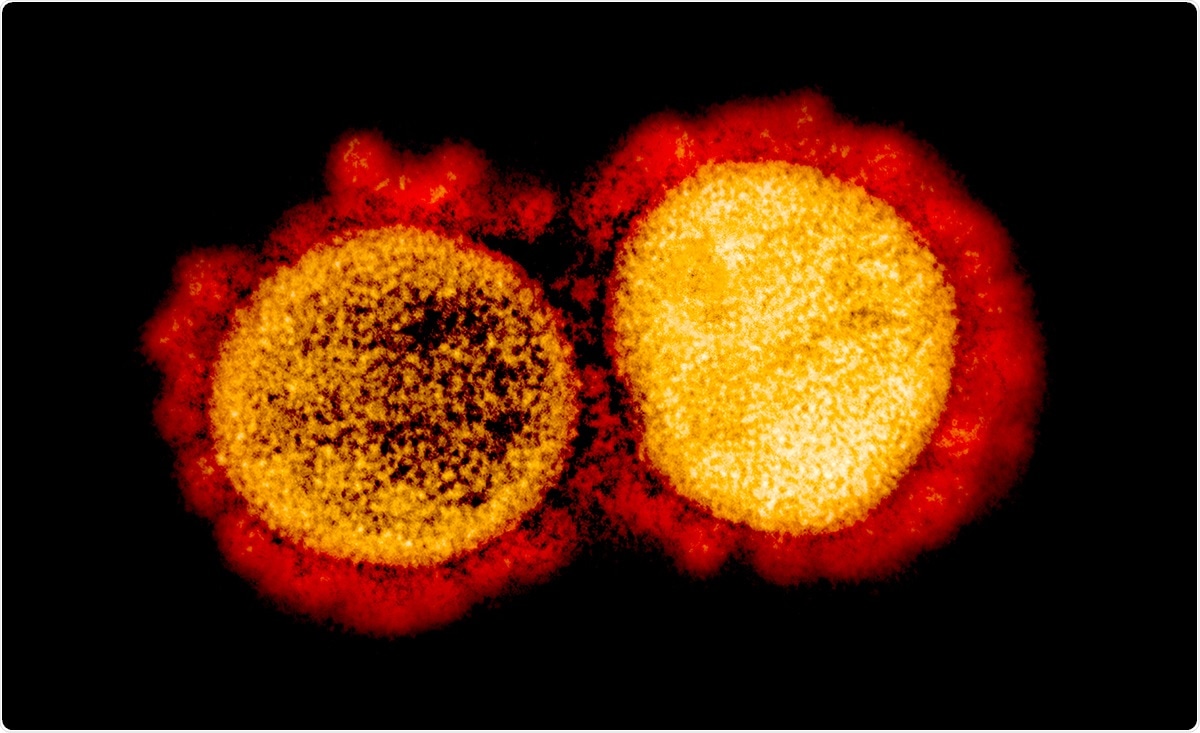 Study: SARS-CoV-2 Antibody Seroprevalence in Wuhan, China, from 23 April to 24 May 2020. Image Credit: NIAID