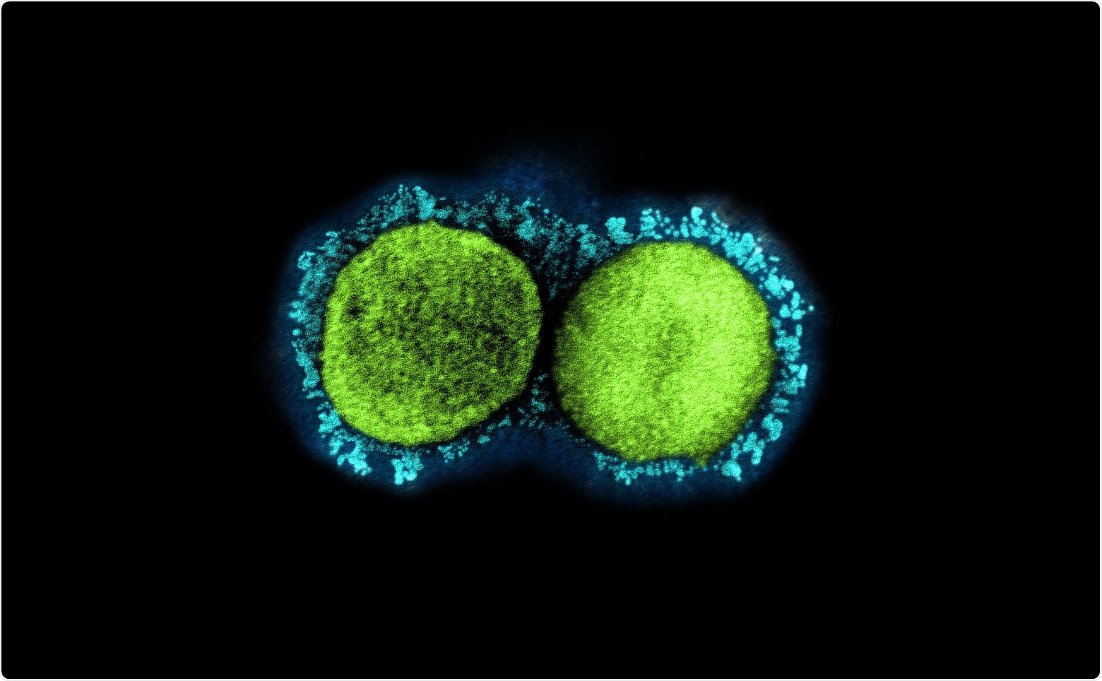 Study: Ultrapotent bispecific antibodies neutralize emerging SARS-CoV-2 variants. Image Credit: NIAID
