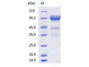 PLBL2 Protein, Chinese Hamster, His-Tagged from Sino Biological