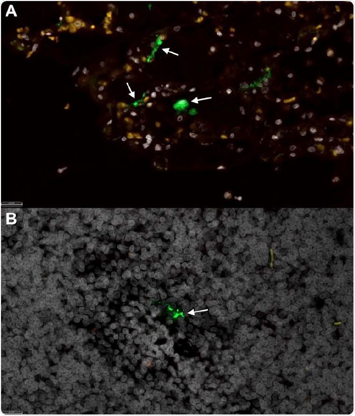 Fluorescent immunohistochemistry for SARS-207 CoV-2 nucleoprotein identifies mononuclear cells in tracheobronchial lymph node of intratracheally-infected cats. Low numbers of SARS-CoV-2 positive cells (green, white arrows) are detected in (A) positive control tissue (lung) from an African Green Monkey infected with SARS-CoV-2 [38], and within (B) mononuclear cells in the TB LN of SARS-CoV-2 infected cats (green, white arrow). White = DAPI/nuclei; green = CoV-2. Magnification (A-B) 40x, scale bar = 20 μm.