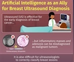 Deep learning algorithms improve diagnostic performance of breast ultrasound