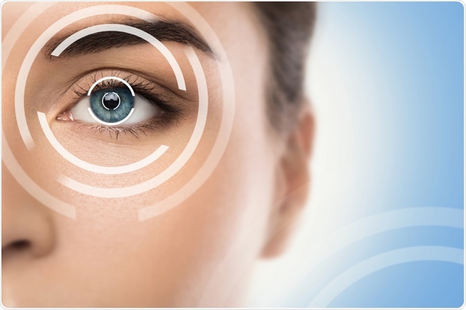 What is LASIK?