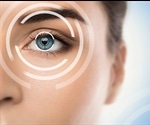 What is LASIK?