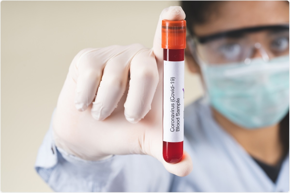 Study: The association of ABO blood group with the asymptomatic COVID-19 cases in India. Image Credit: Banu Sevim / Shutterstock