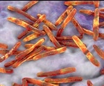 Nontuberculous Mycobacteria Research