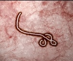 Ebola Virus History