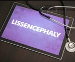 Lissencephaly Types