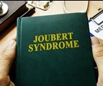 Joubert Syndrome Genetics