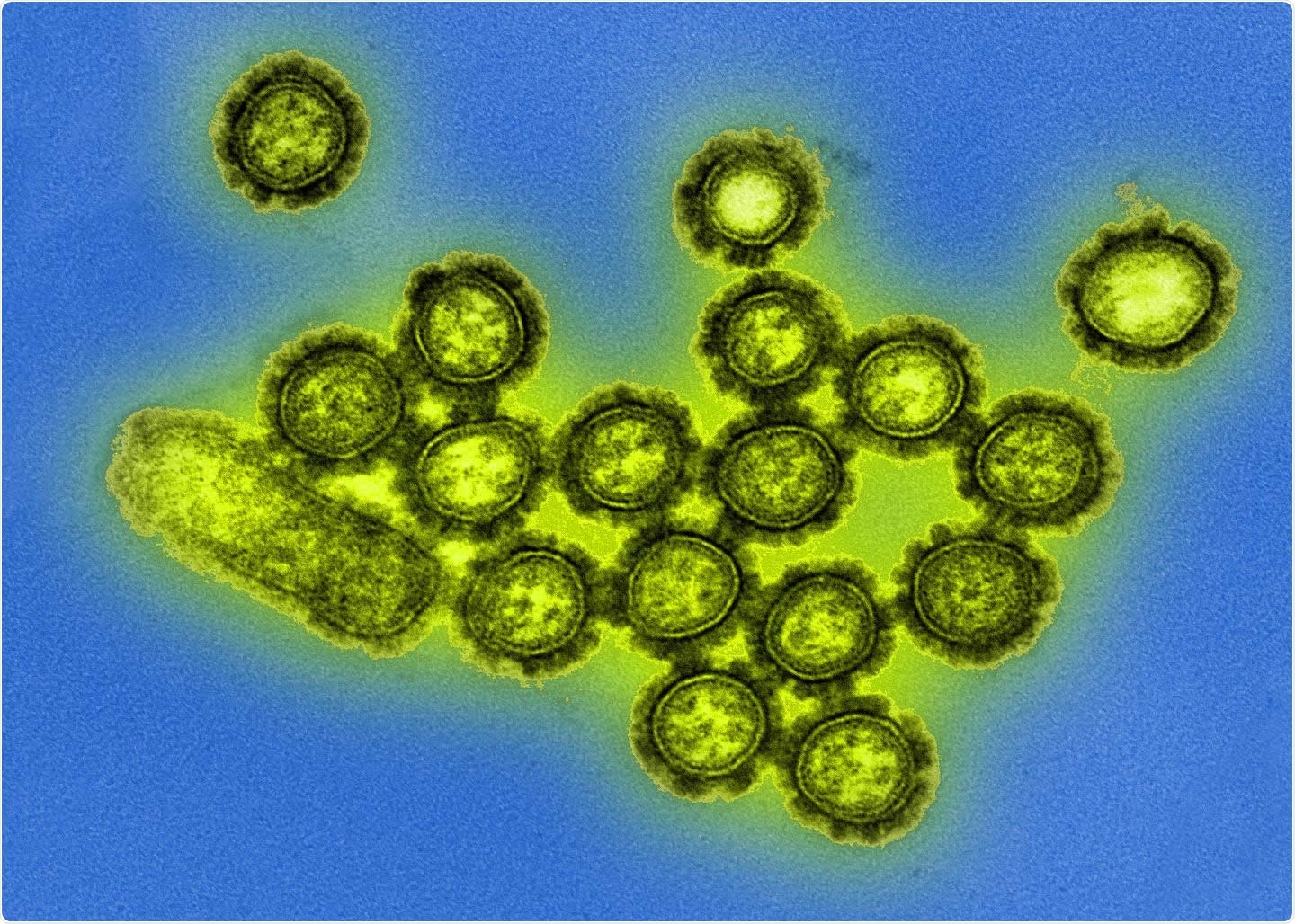 Study: Evidence for Deleterious Original Antigenic Sin in SARS-CoV-2 Immune Response. Image: H3N2 influenza virions. Image Credit: CDC/Michael Shaw, Doug Jordan