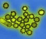 Previous H3N2 influenza A infection may explain some cases of severe COVID-19