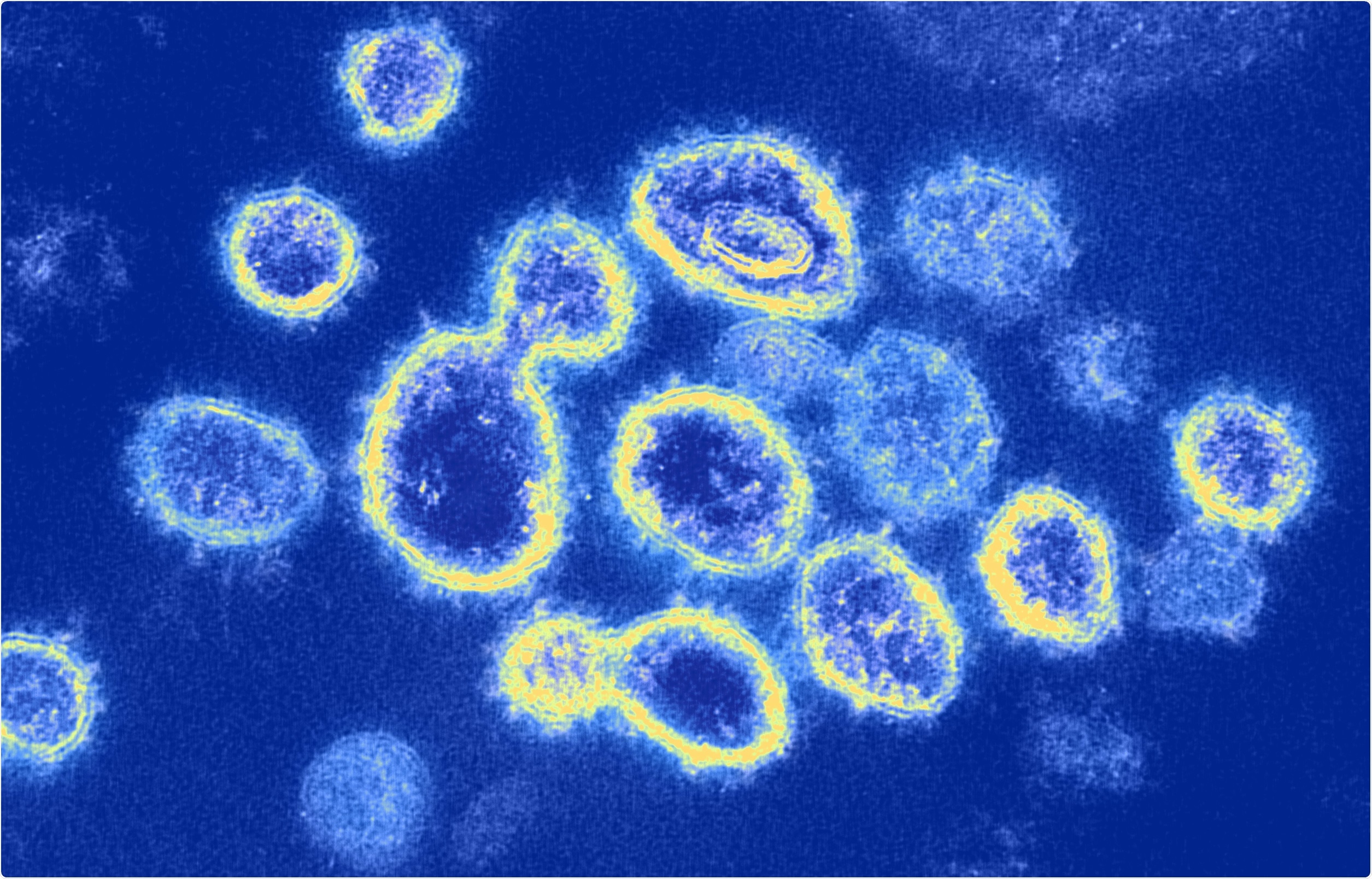 Study: Prophylactic protection against respiratory viruses conferred by a prototype live attenuated influenza virus vaccine. Image Credit: NIAID