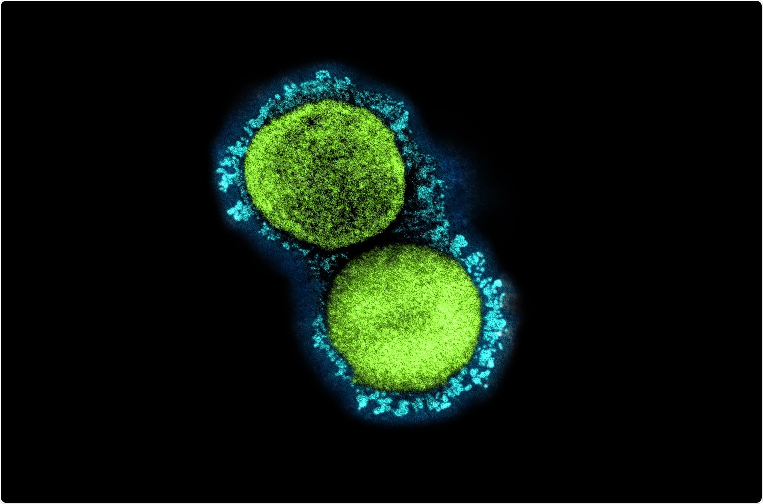 Estudio: Inmunidad heteróloga protectora del linfocito T en COVID-19 inducido por el MMR y los antígenos de la vacuna de Tdap. Haber de imagen: NIAID