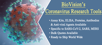 Coronavirus Research Tools: Assay kits, ELISA, Proteins, Antibodies and More