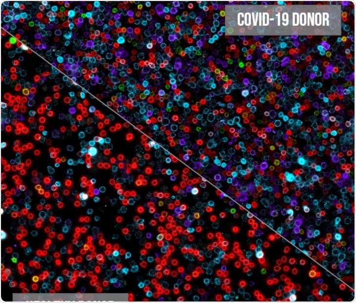 Canopy Biosciences develops spatial proteomics assay for COVID-19