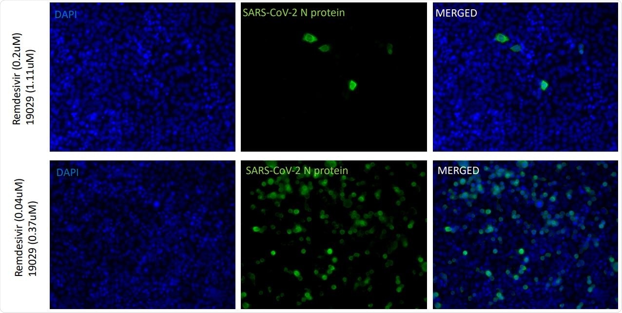 Combinations of NBDNJ and Remdesivir to suppress SARS-CoV-2. Human lung (carcinoma) A549ACE2 cells were infected with SARS-CoV-2 (USA-WA1/2020 strain) in the absence and presence of vary concentrations of drugs, and after 48 hours, stained with anti nucleocapsid antibody and images (20X) read in the blue filter to detect DAPI stain
