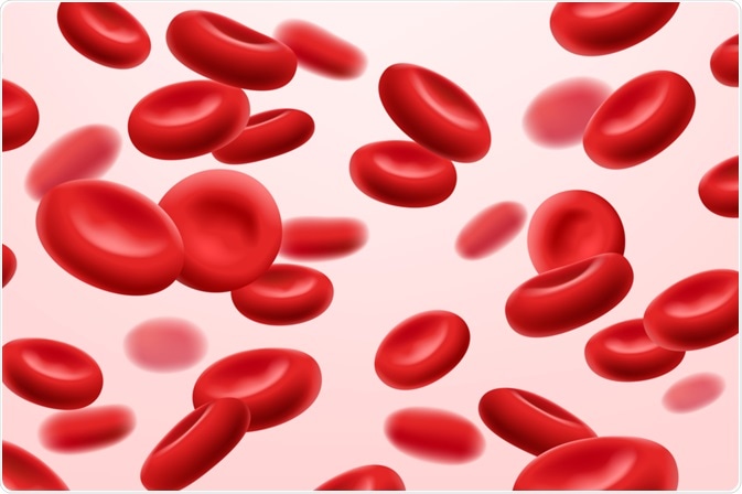 anemia 5 hemoglobina