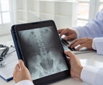What is Teleradiology?