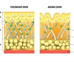 Glycation and Skin Aging