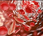 COVID-19 and Sickle Cell Disease