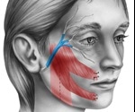 Facial Nerve Decompression