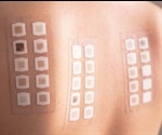Allergy Patch Testing