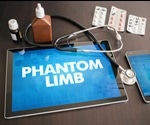 What is a Phantom Limb?