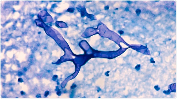 Mucormycosis Microscopic