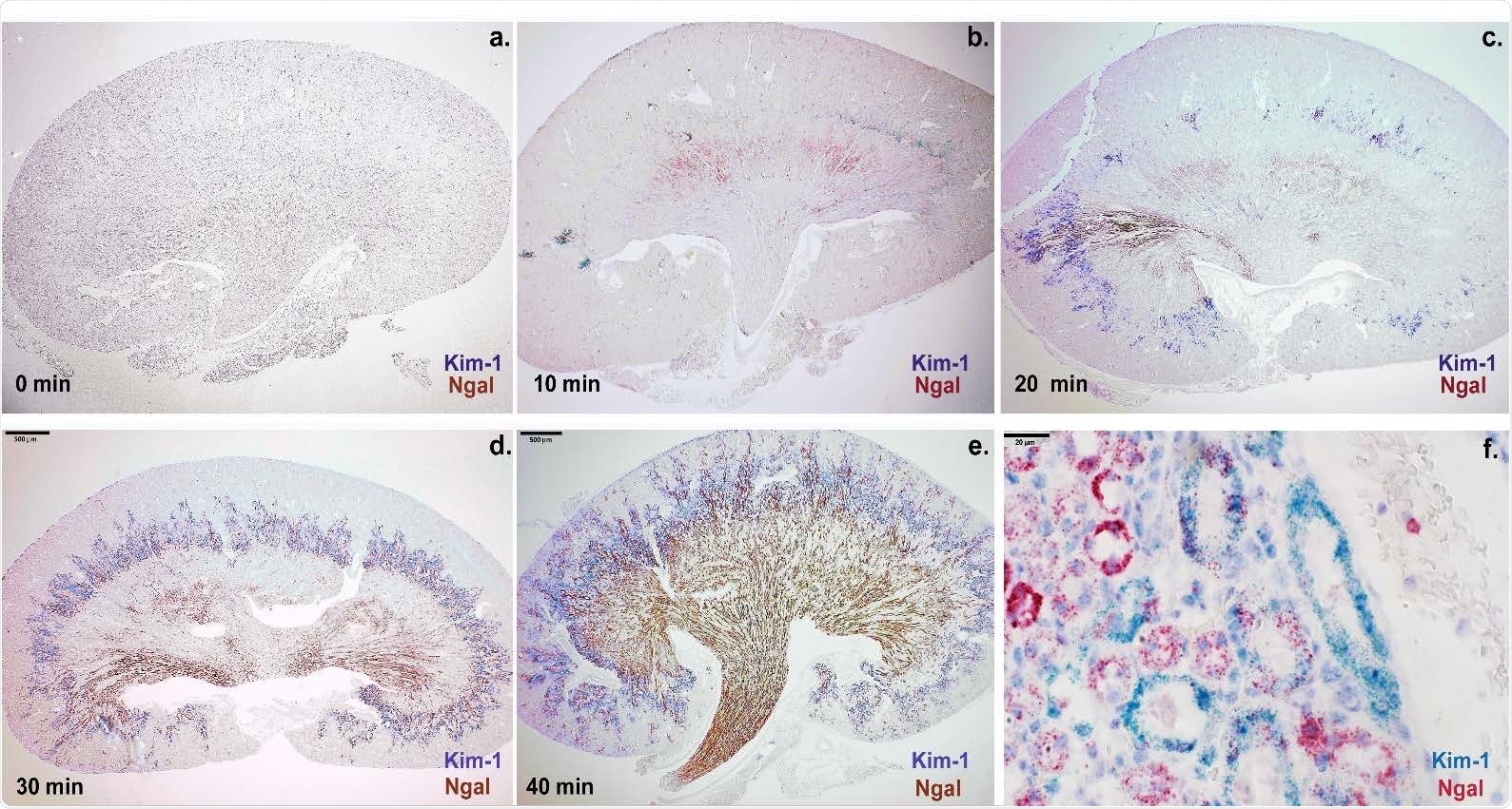 The expression level of Ngal (red-brown) and Kim-1 (blue-purple) depended on the dose of arterial ischemia in mouse: (a-e) Ngal expression was found at the cortico-medullary junction after 10min of ischemia, but throughout the medulla and papilla after 30-40min of ischemia. Kim-1 expression was found in the cortex and throughout the cortico-medullary junction. (e-f) Prolonged ischemia (40min) broadened the expression domain of Ngal to include the proximal tubule marked by Kim-1. In contrast to Ngal, Kim-1 expression remained localized to the cortex and cortico-medullary junction. Bars a-e: 500μm; Bars f: 20μm.