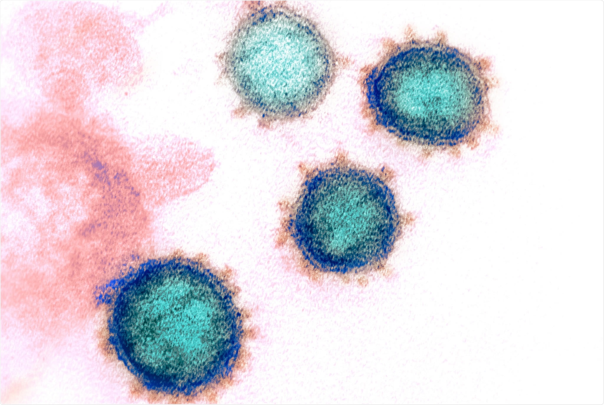 Study: SARS-CoV-2 can recruit a heme metabolite to evade antibody immunity. Image Credit: NIAID