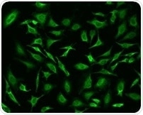 Immunofluorescence staining of mouse target A in NIH-3T3 cells. Positive staining was localized to Mitochondrion