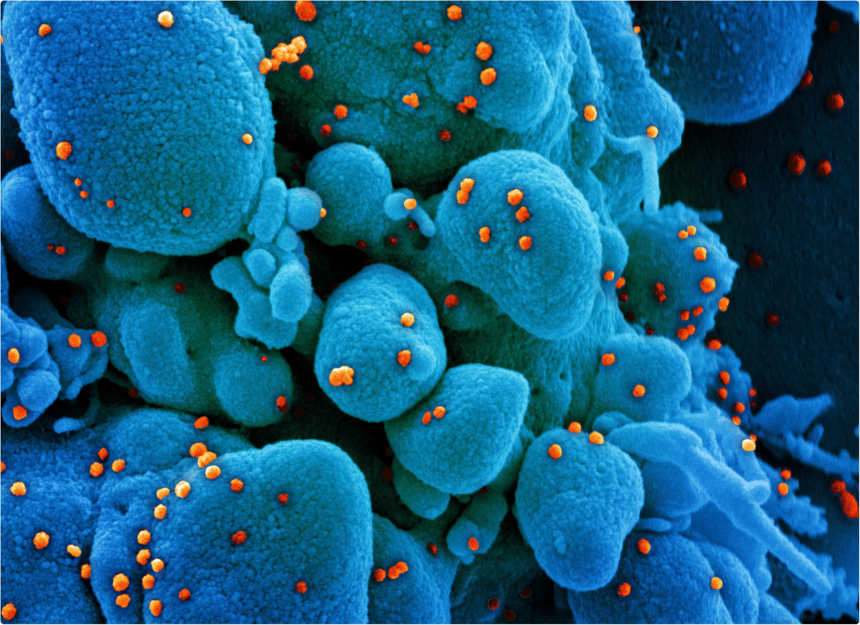 Study: Binding of phosphatidylserine-positive microparticles by PBMCs classifies disease severity in COVID-19 patients. Image Credit: NIAID