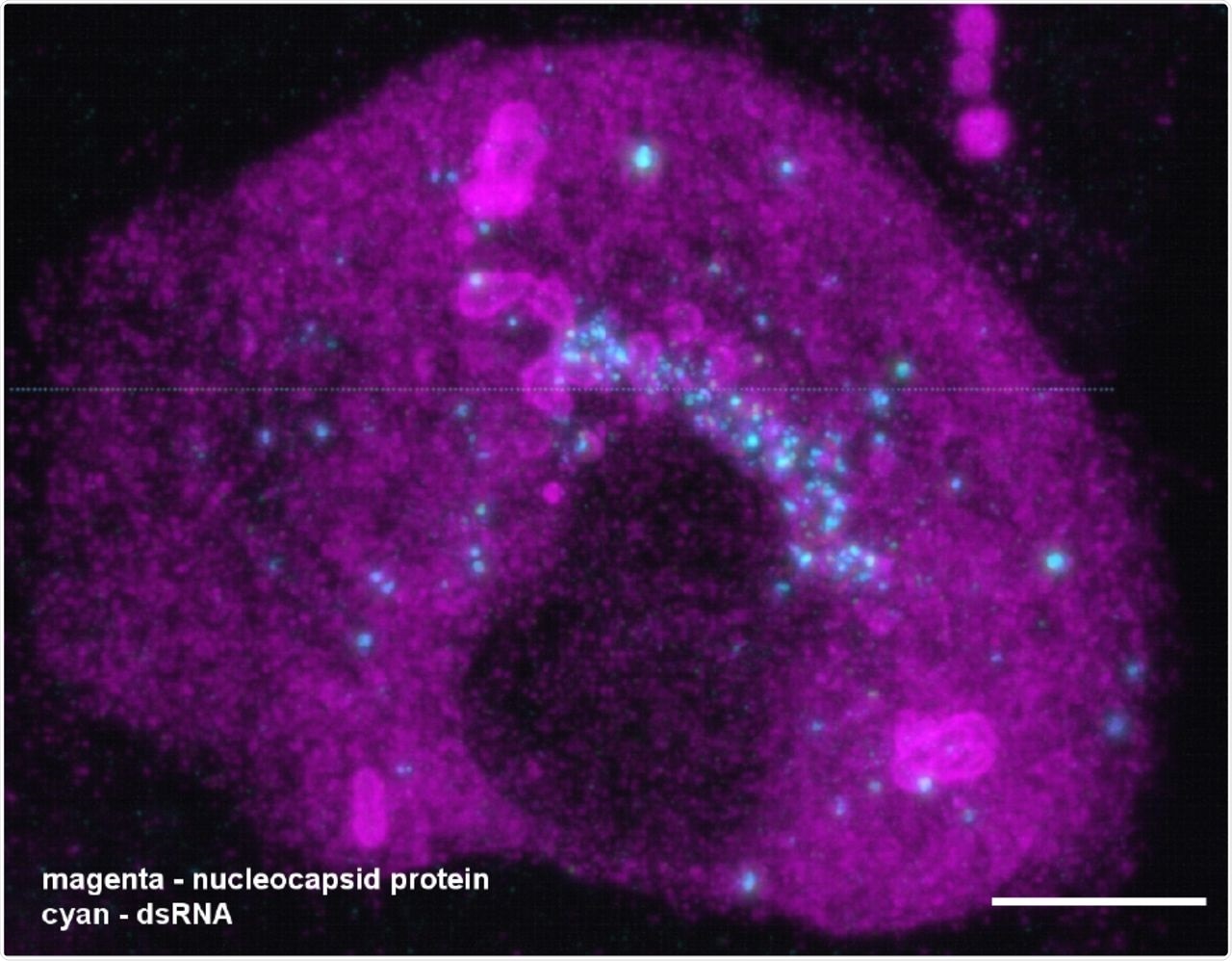 A combination of expansion and light sheet microscopy reveals the interaction between dsRNA (cyan) and the nucleocapsid protein N (magenta) in SARS-CoV-2 infected Vero cells. The video corresponds to Figure 3G in the main manuscript. The majority of dsRNA foci are located in a region immediately adjacent to the nucleus. In addition, most N compartments contain dsRNA foci sitting in the layers of the compartments. Scale bar 5 μm (taking into account an expansion factor of 4.2).