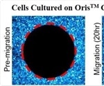 The Role Surface Coatings Play in Cell Migration