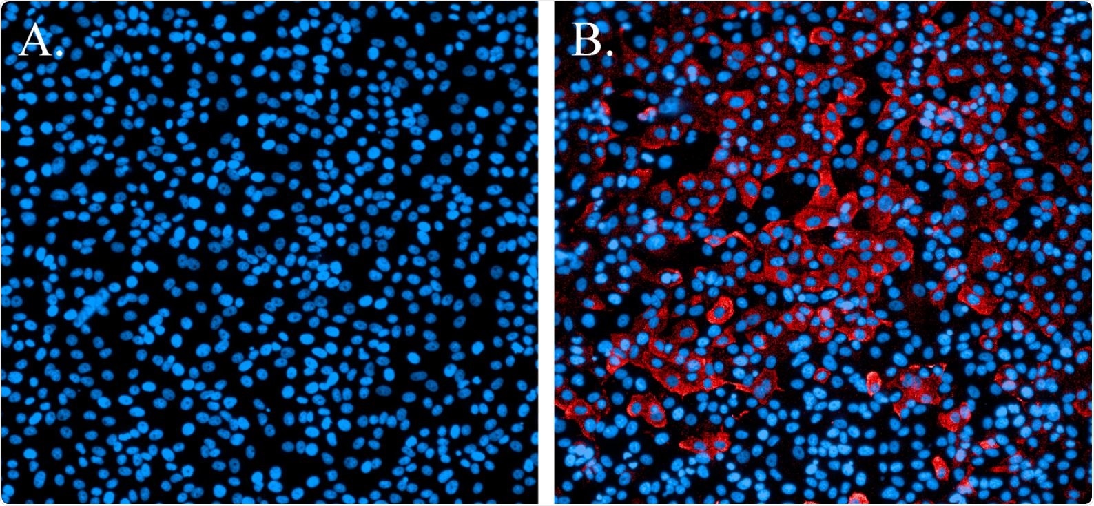 Immunofluorescence staining of SARS-CoV-2-infected cells. (A). Non-infected cells stained with Hoechst nuclear stain (blue). (B). Cells infected with SARS-CoV-2 and probed with a SARS-CoV N-protein-specific antibody and Alexa594 secondary antibody (red). Cells were counterstained with Hoechst nuclear stain (blue).