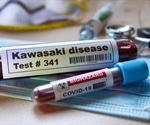 Potential transmission for Kawasaki disease unexpectedly uncovered due to COVID-19