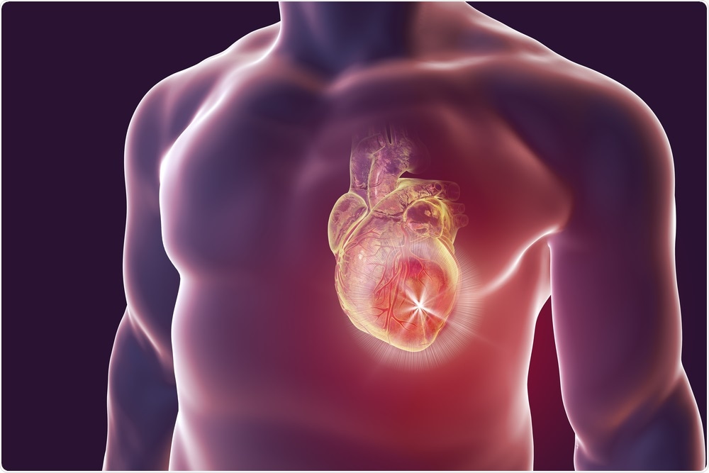 Study: Myocarditis after SARS-CoV-2 Vaccination: A Vaccine-induced Reaction? Image Credit: Kateryna Kon / Shutterstock