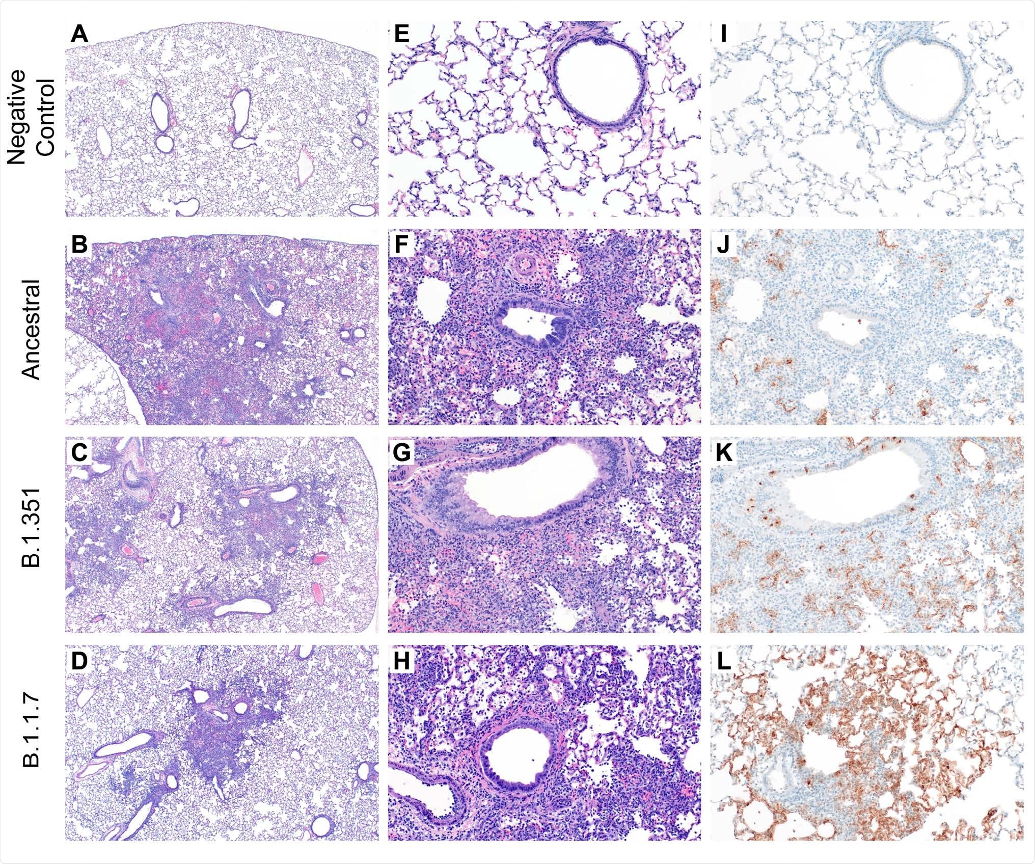 Histopathology and Immunohistochemistry of hamster lungs. (A-H) Representative H&E images of lungs of hamsters infected with 105 TCID50 of ancestral, B.1.1.7, and B.1.351 variants at 4 days post-challenge (DPC). Foci of interstitial pneumonia and bronchiolitis were observed throughout all evaluated lung lobes of infected hamsters. (I-L) Immunohistochemistry (IHC) detected SARS-CoV-2 nucleocapsid staining in the lungs of all infected hamsters.