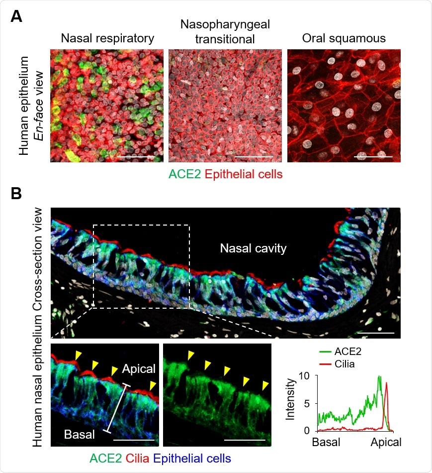 ACE2 in Nasal Cells