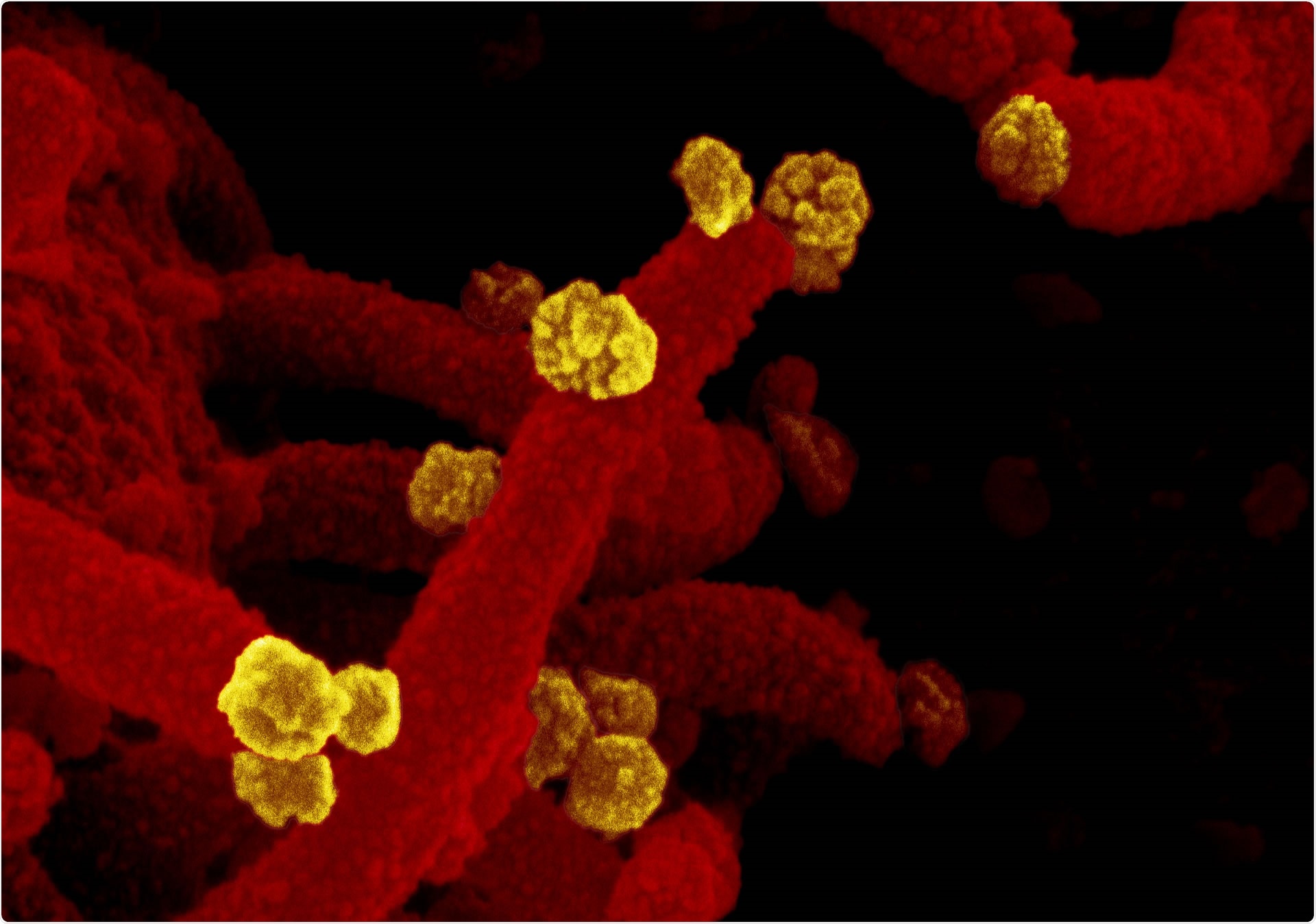 Study: Zinc-Embedded Polyamide Fabrics Inactivate SARS-CoV-2 and Influenza A Virus. Image Credit: NIAID