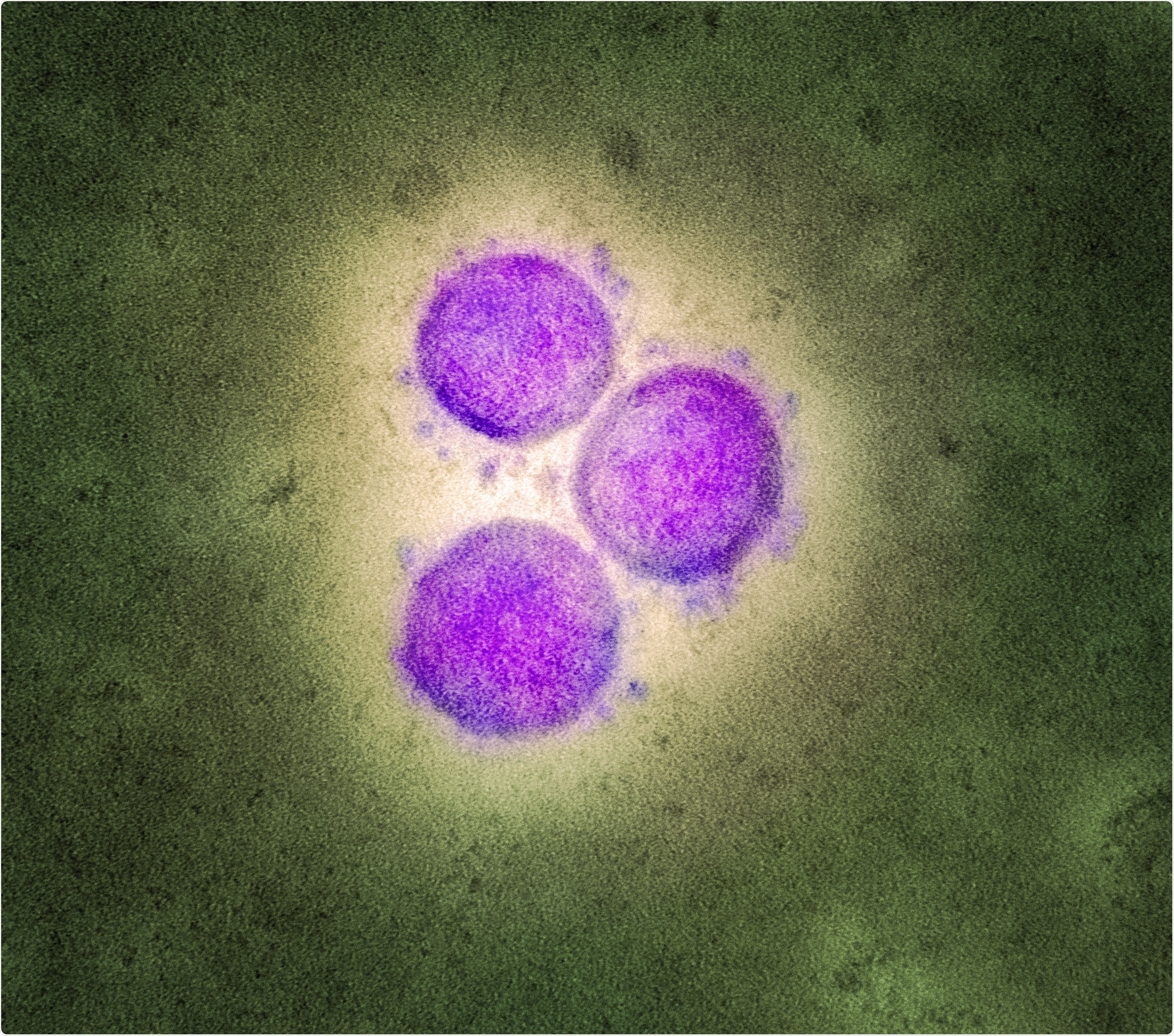 Study: Rapid determination of the wide dynamic range of SARS-CoV-2 Spike T cell responses in whole blood of vaccinated and naturally infected. Image Credit: NIAID